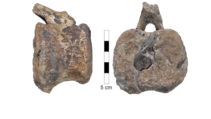 Sëmundja e rrallë që prek fëmijët është zbuluar në fosilet e një dinozauri 66 milionë vjeçar