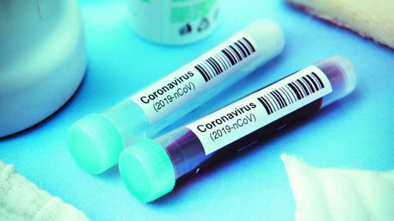29 raste të reja me koronavirus në Maqedoninë e Veriut, shkon në 114 numri i të prekurve