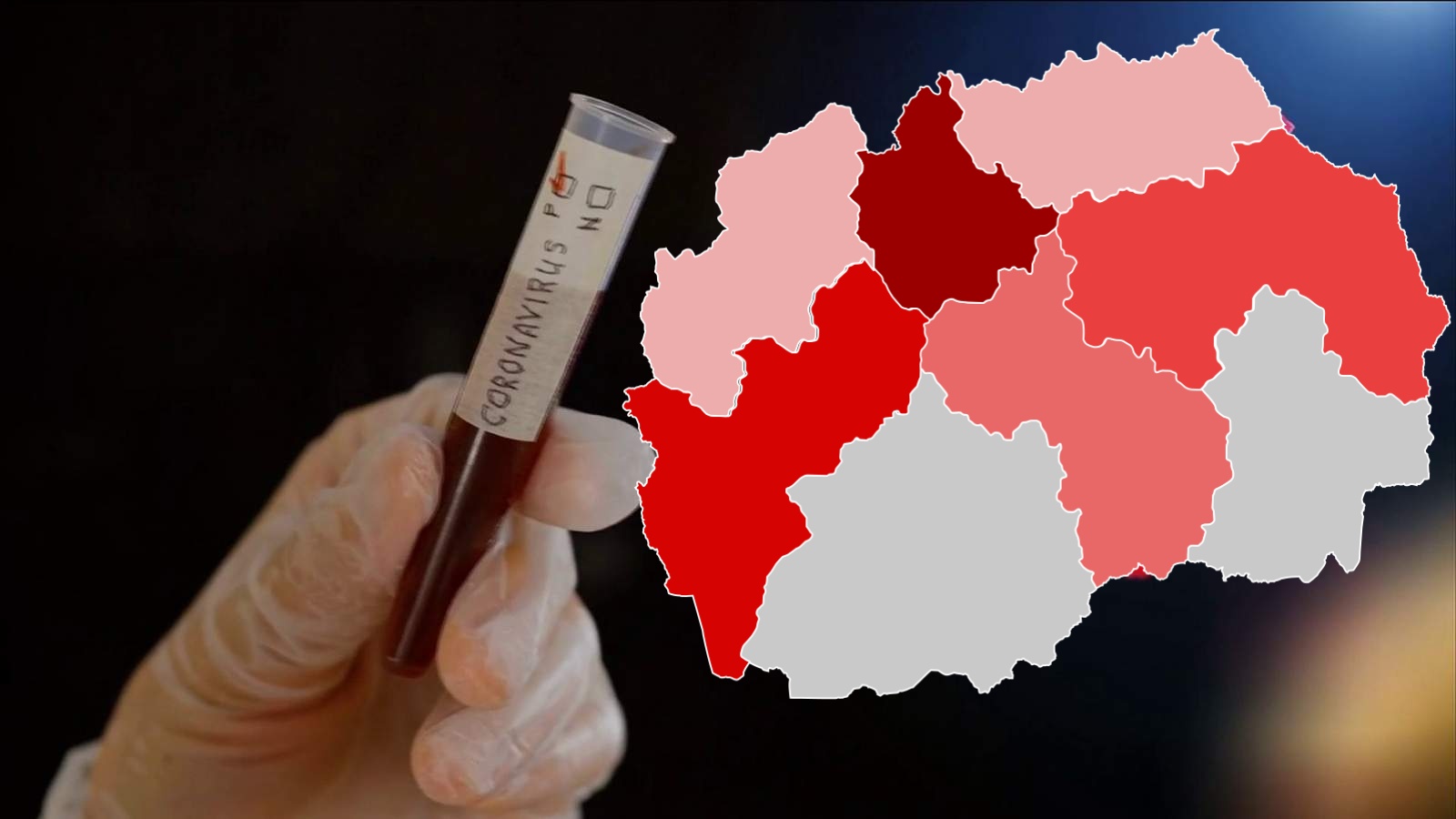 36 raste të reja me koronavirus në Maqedoninë e Veriut, tre persona humbin jetën