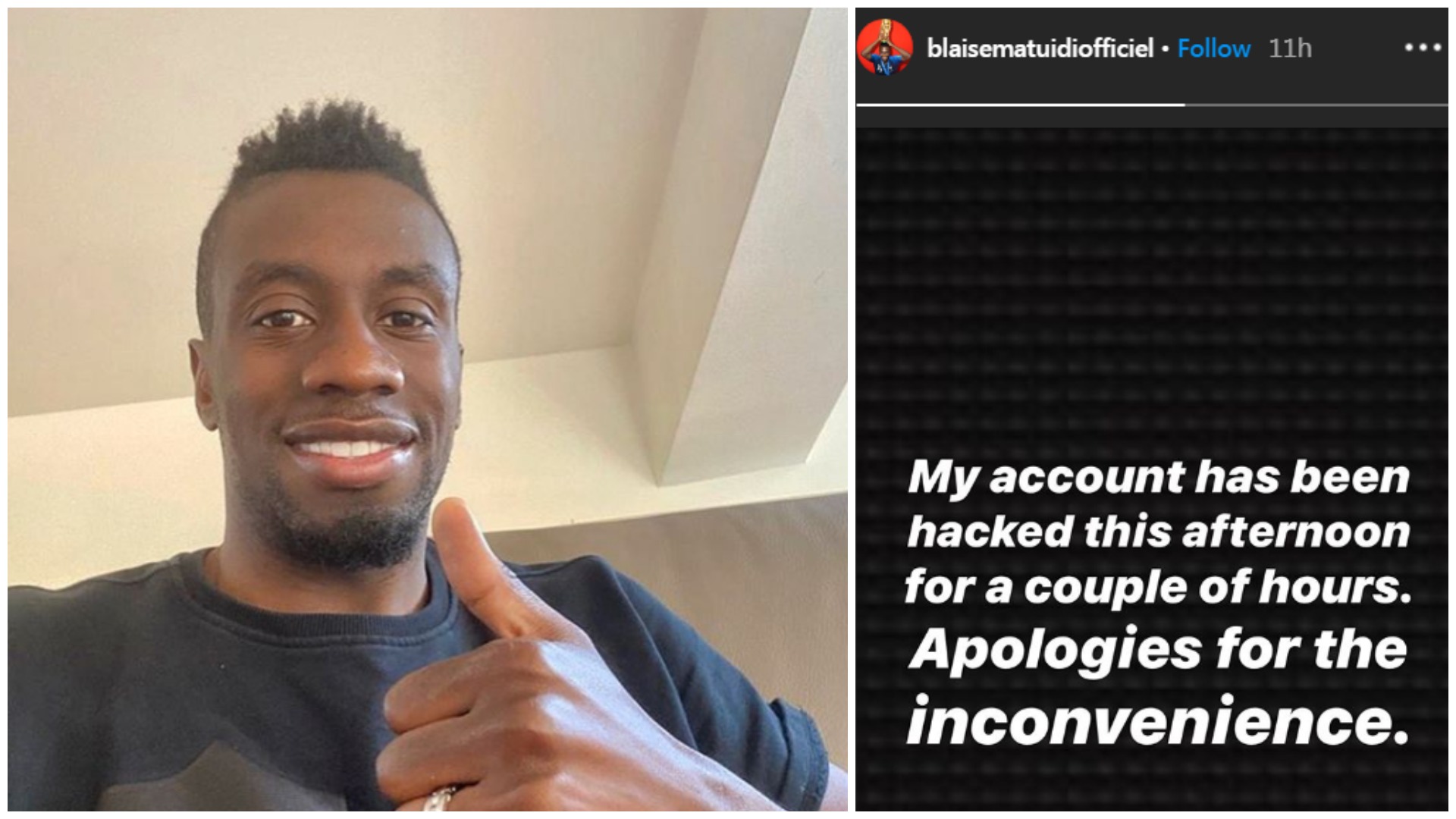 “Ishte vetëm për qejf”, Blaise Matuidi e pëson nga piratët e internetit