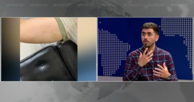 U dhunua në protestë, inxhinieri: Më qëlluan e ofenduan nga familja, kam çarje të daulles së veshit