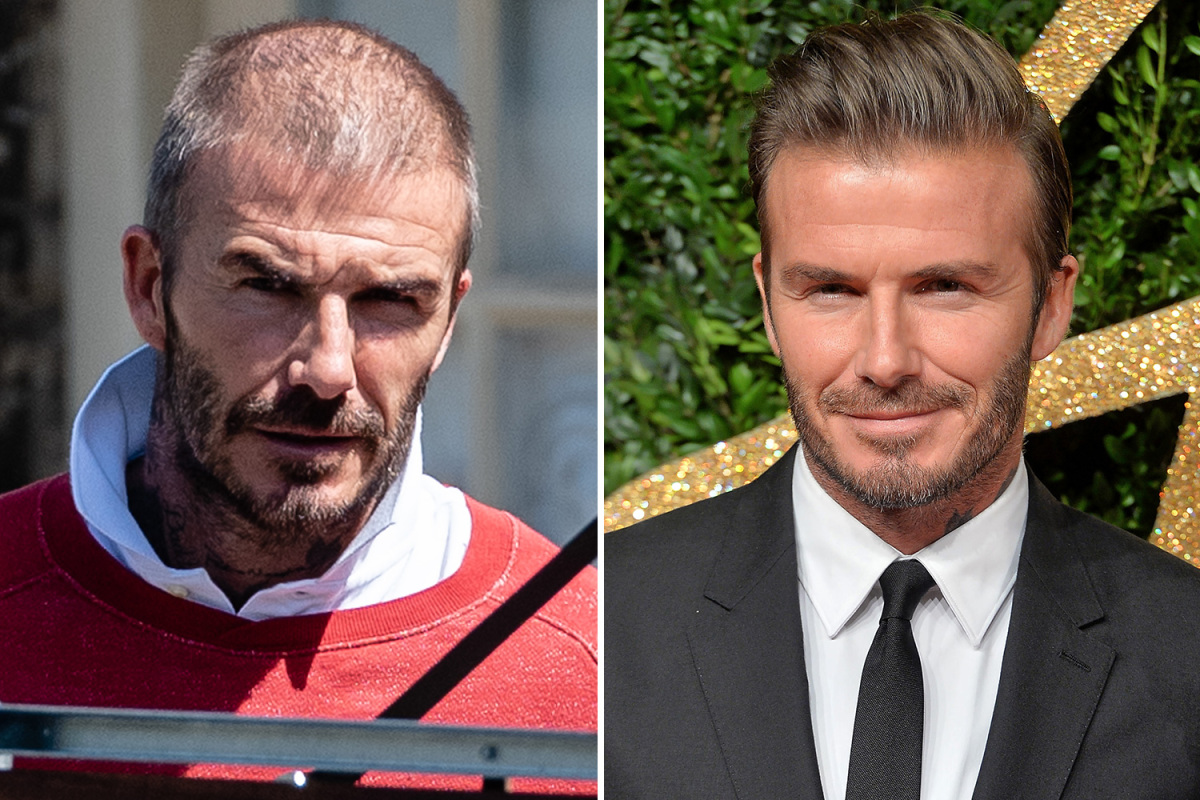 Çfarë ka ndodhur me David Beckham? Ikona e futbollit fotografohet pa flokë