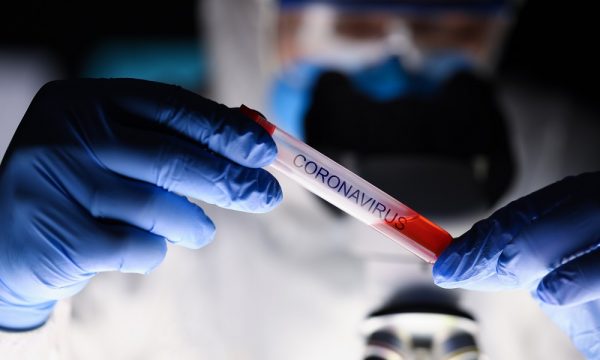 Gjatë 24 orëve vetëm 1 rast me koronavirus në Kosovë