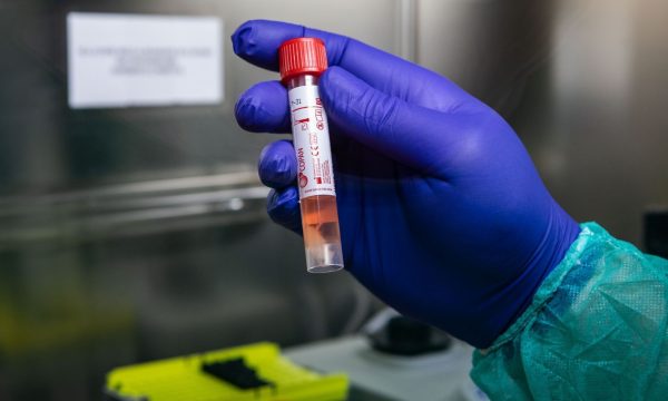 Shënohet vetëm 1 rast me koronavirus në Kosovë gjatë 24 orëve