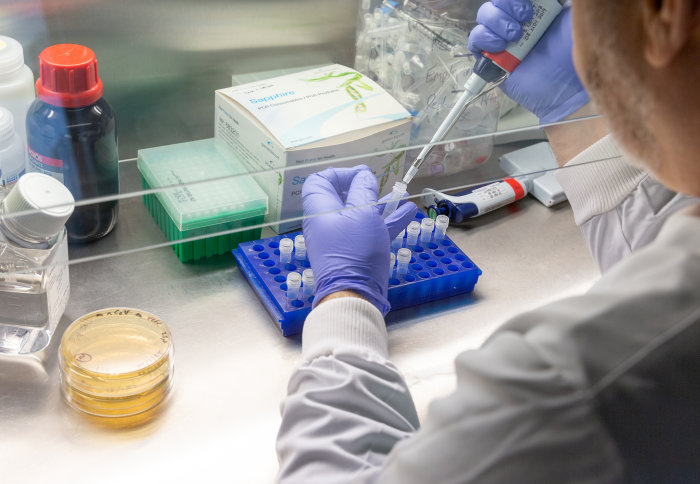 OBSH paralajmëron: Koronavirus mund të mos zhduket kurrë