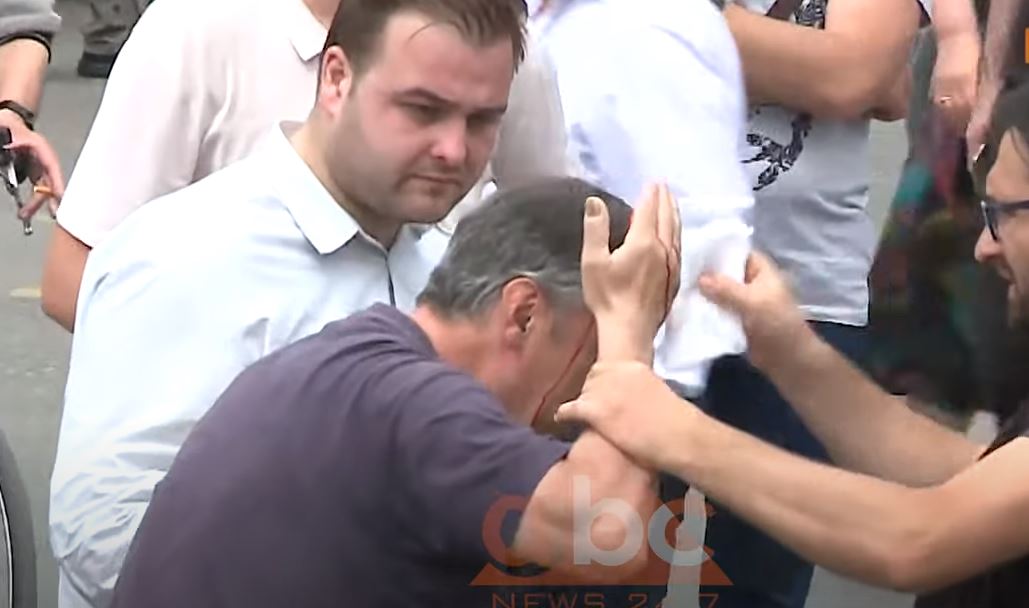 Përplasja te Teatri Kombëtar, gjakoset një qytetar