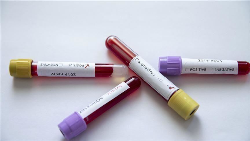 Një viktimë dhe 10 raste të reja me Covid-19 në 24 orë në Maqedoninë e Veriut