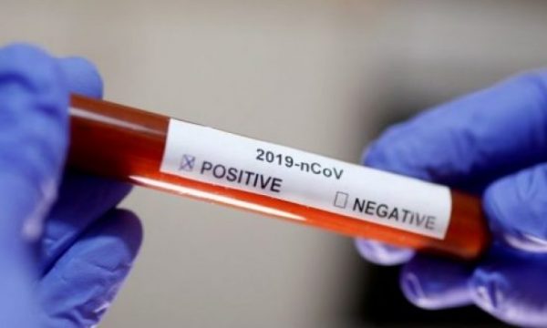 Konfirmohen 96 raste të reja me Covid-19 në Kosovë