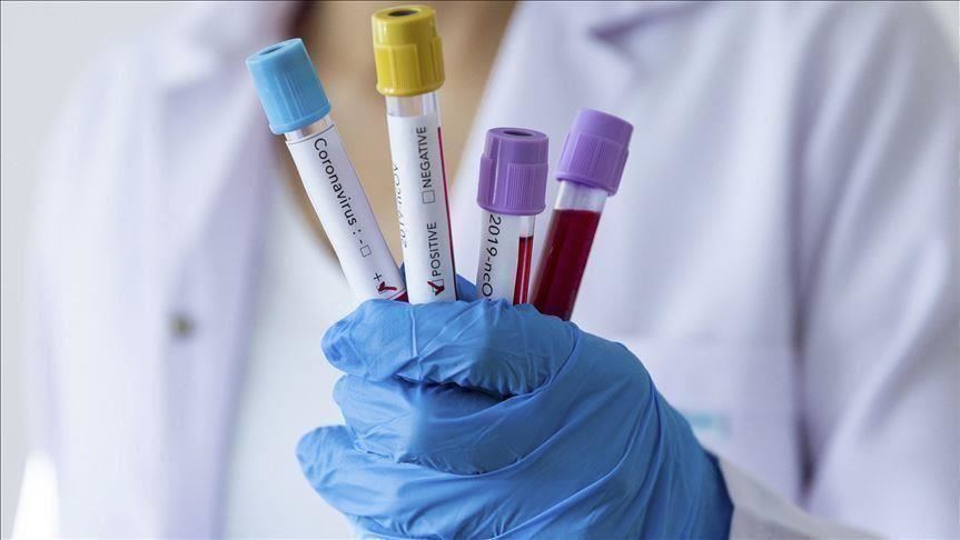 Konfirmohen 176 raste të reja dhe 9 viktima në Maqedoninë e Veriut në 24 orët e fundit