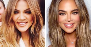 Vështirë të njihen, vipat që kanë pësuar ndryshime drastike në vitet e fundit (FOTO)