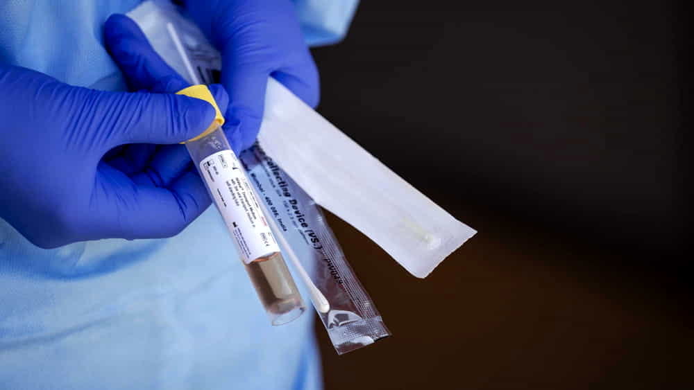 Të kthyerit nga Kosova burim infeksioni në Itali, 55 vjeçari me Covid lahet në pishinë