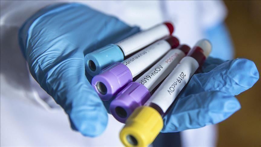 Maqedonia e Veriut, regjistron 188 raste të reja me Covid-19, humbin jetë dhe 5 pacientë