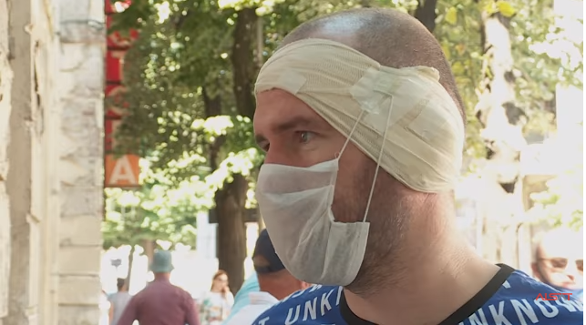 I riu shqiptar denoncon dhunën: Polici serb më rrahu derisa më ra të fikët