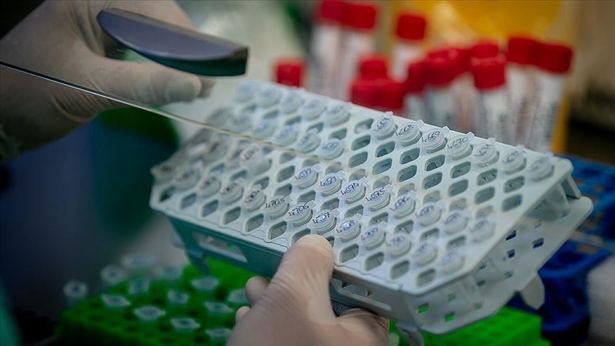 Rritet numri i viktimave me Covid në Maqedoninë e Veriut, konfirmohen 139 raste të reja