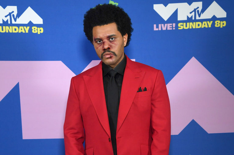 U shfaq i gjakosur në MTV VMAs, The Weeknd ka një arsye shumë të fortë