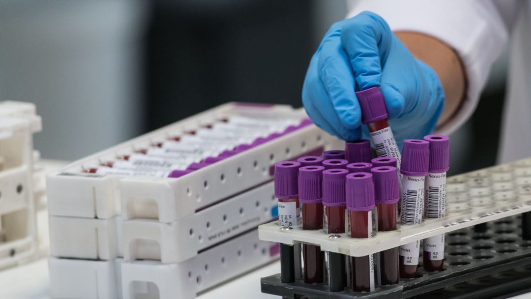 Kosovë, MSH licencon pesë laboratorë privatë për testet e koronavirusit