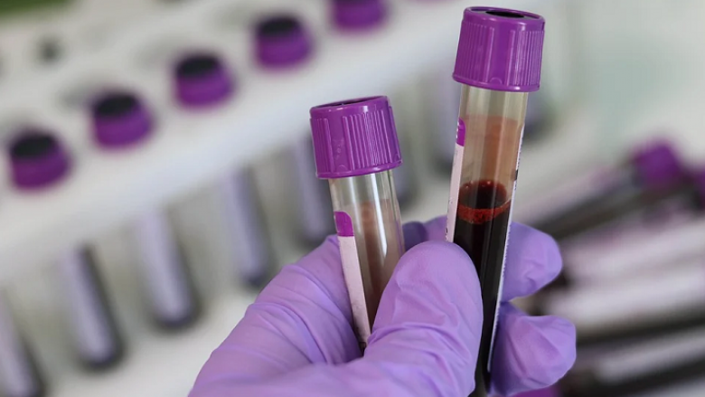 127 raste të reja me Covid në Maqedoni, humbin jetën 5 persona