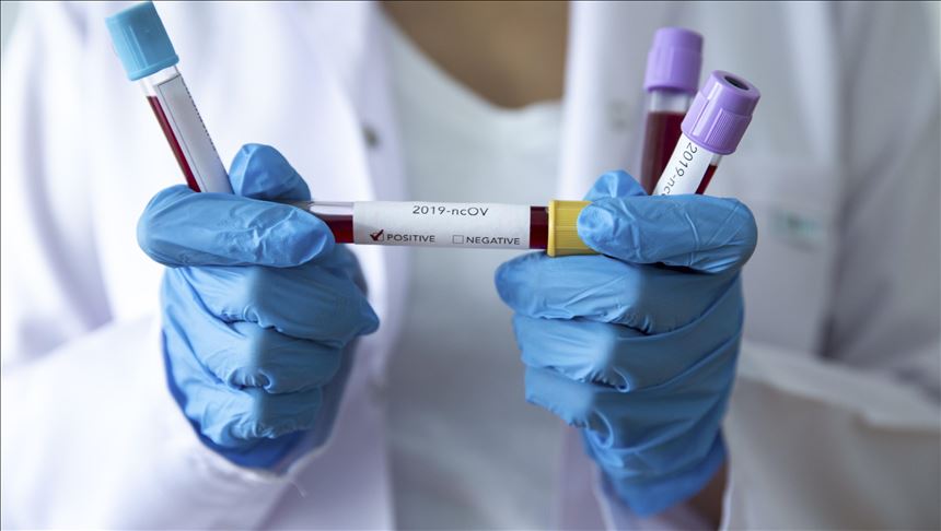 Rritet numri i viktimave nga Covid në Maqedoni, konfirmohen 121 raste të reja