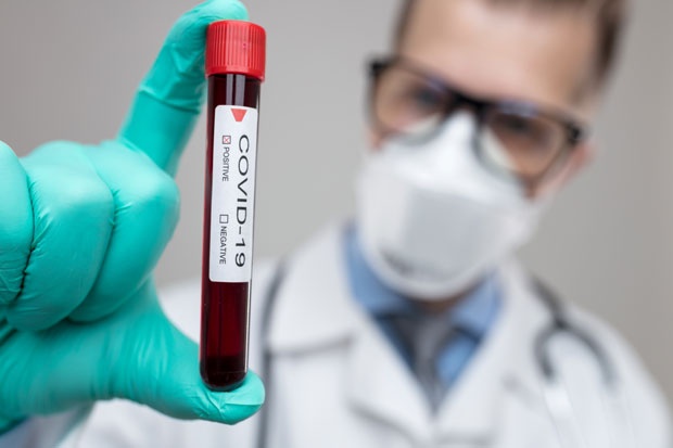 Rekord të infektuarish me Covid në Maqedoni, humbin jetën 12 pacientë