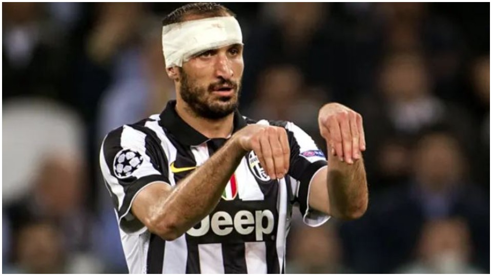 Chiellini shqetëson Juventusin, mund të mungojë një muaj