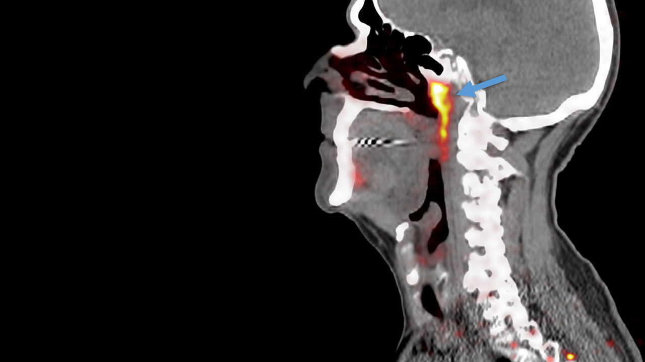 Shkencëtarët zbulojnë një organ të ri në trupin e njeriut