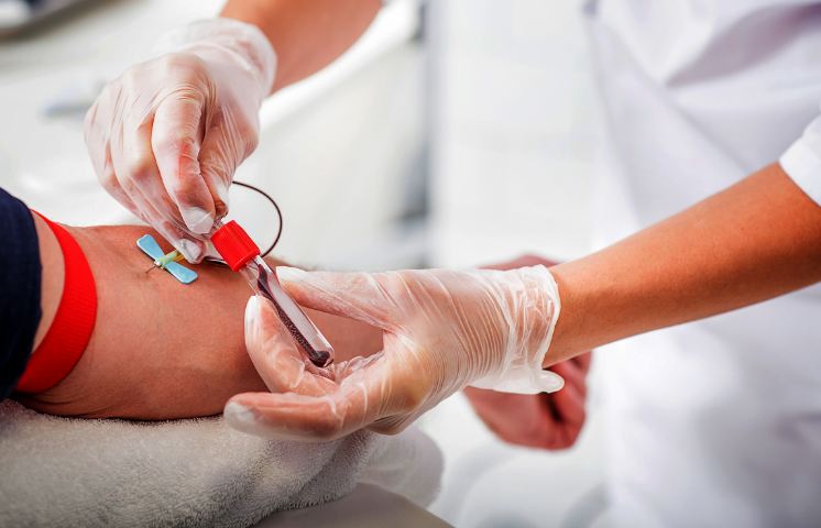 Kosova nis procedurat për përdorimin e plazmës së gjakut për pacientët me COVID-19