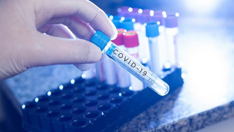 6 viktima dhe 438 raste të reja me COVID-19 në Maqedoninë e Veriut