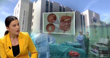 Mjekja: Fazat e sëmundjes së zorrës së trashë, shkaqet dhe ushqimet që duhen konsumuar