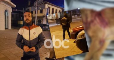 FOTOT/ Goditën qenin me thikë 15 cm, identifikohen dy autorët në Shkodër