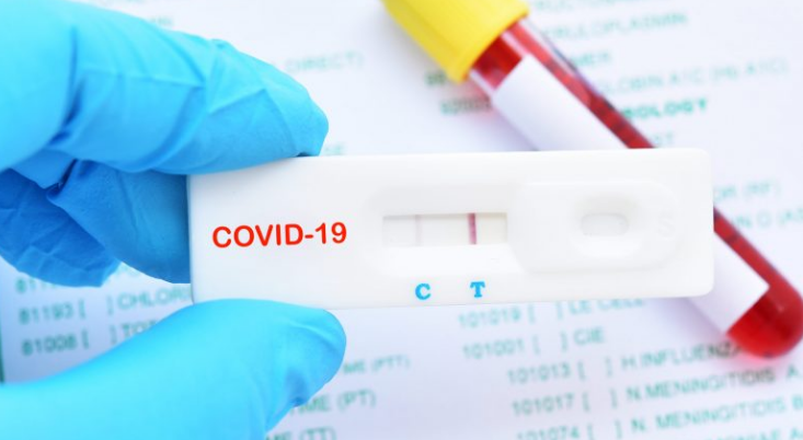 Maqedonia e Veriut konfirmon 1,161 raste të reja me Covid, 26 qytetarë humbën jetën