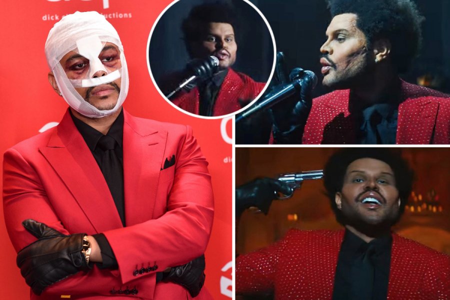 Ndërhyrje kirurgjikale? The Weeknd befason me pamjen në videoklipin e ri