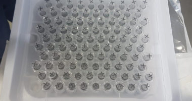 Interpol: Rrjeti i vaksinave false Covid zbulohet në Afrikën e Jugut dhe Kinë