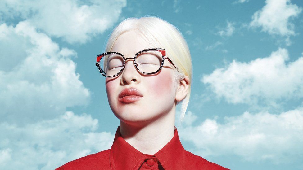 Historia e modeles së Vogue që prindërit e braktisën sepse ishte me albinizëm