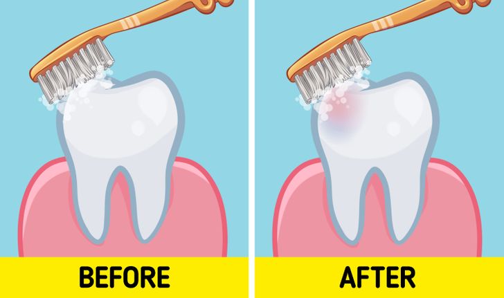 Para apo pas mëngjesit? Dentistët tregojnë kur duhet t’i lani dhëmbët