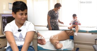 7-vjeçari që donte protezë nis të ecë pas operacionit të 15-të, nëna nuk përmban emocionet