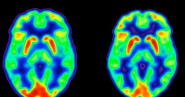 Lajm i mirë befasues se si menopauza ndryshon trurin tuaj