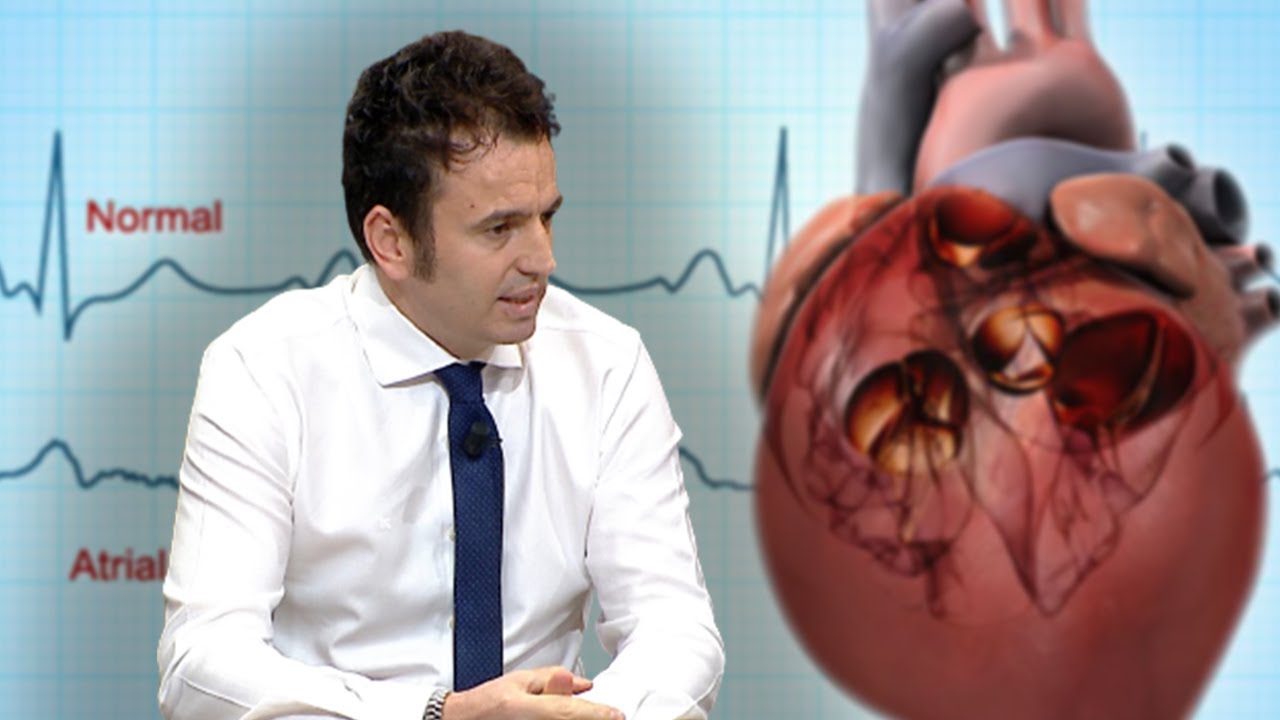 Çfarë është, si diagnostikohet dhe si trajtohet Fibrilacioni Atrial – Dr. Shk. Alfred Nona – Spitali Amerikan