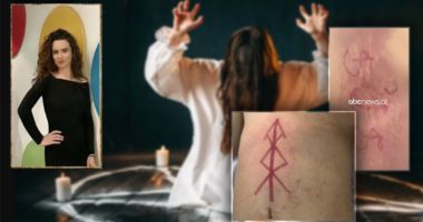 23-vjeçarja me shenja të trup, eksperti: I bindur që i është nënshtruar një rituali okult, e kanë sakrifikuar