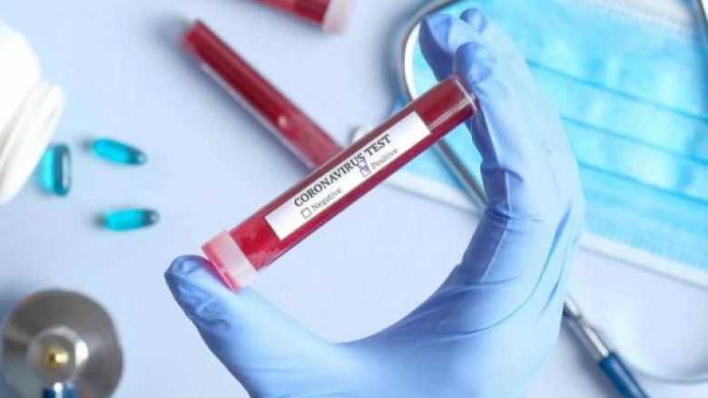 26 raste me Covid dhe asnjë viktimë në Maqedoninë e Veriut