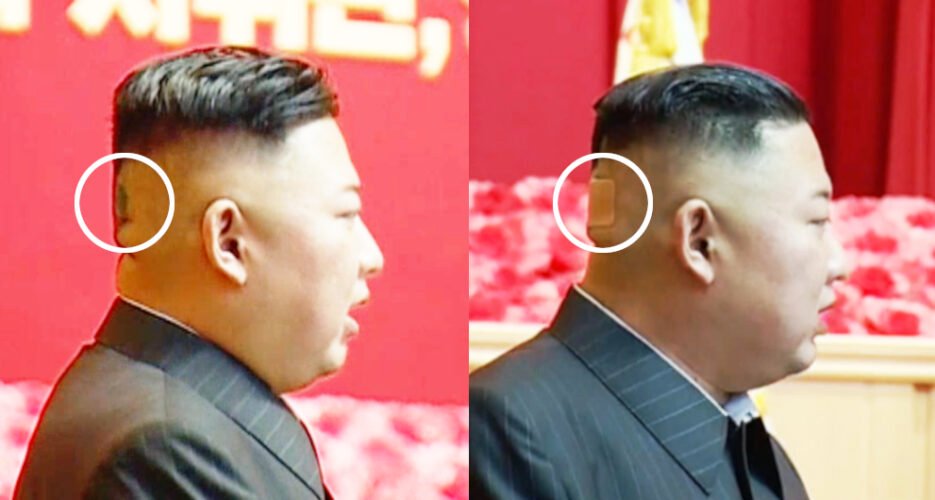 “Me një shenjë të errët në kokë”, skenarët e rinj për shëndetin e Kim Jong Un