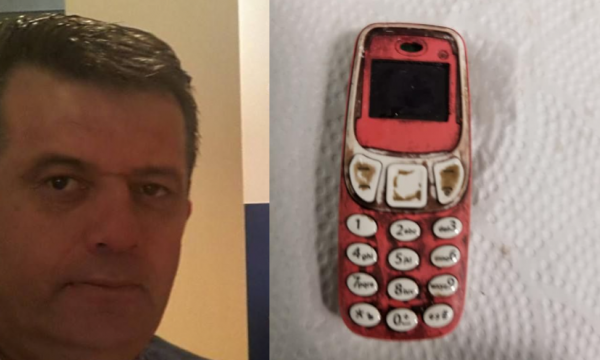 I riu në Kosovë gëlltit telefonin, mjekët punojnë me orë të tëra për t’ia nxjerrë