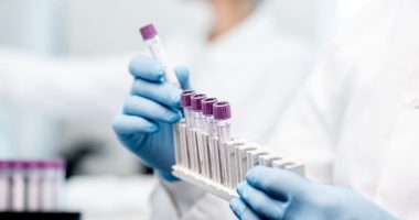 Do të udhëtoni nga porti i Durrësit dhe ju duhet testi anti-COVID? Ja ku mund ta bëni lehtësisht