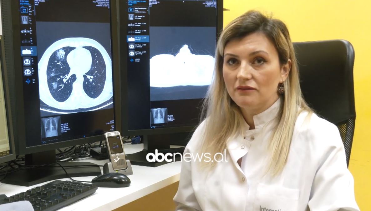 Radiologët: Të pavaksinuarit prekje më të rëndë pulmonare