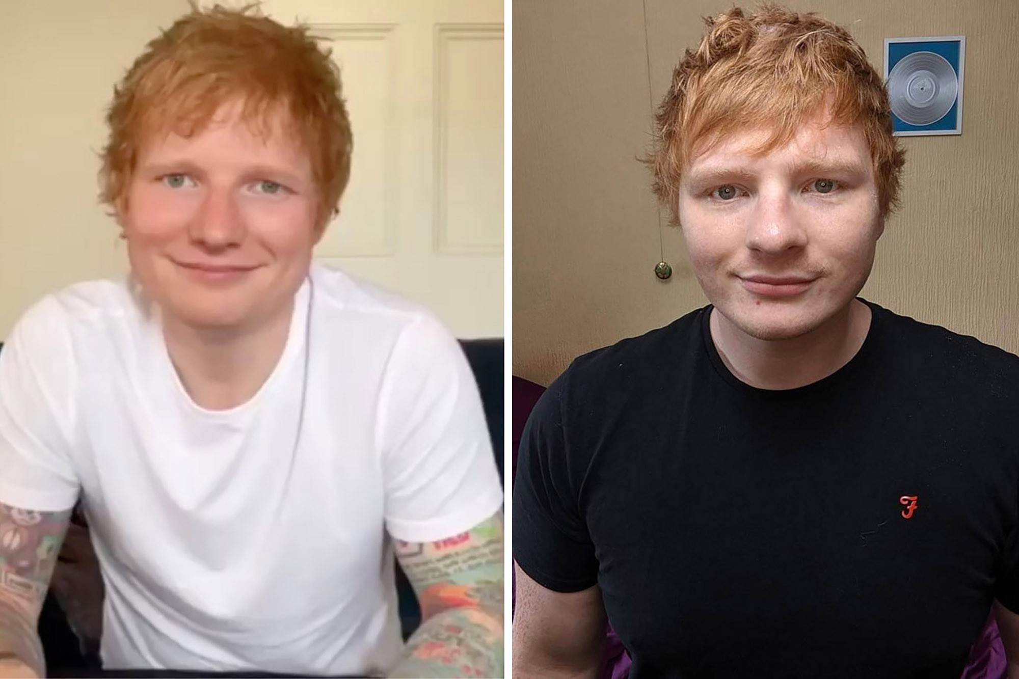 Fansat e ngatërrojnë me Ed Sheeran, sozia e këngëtarit detyrohet të maskohet