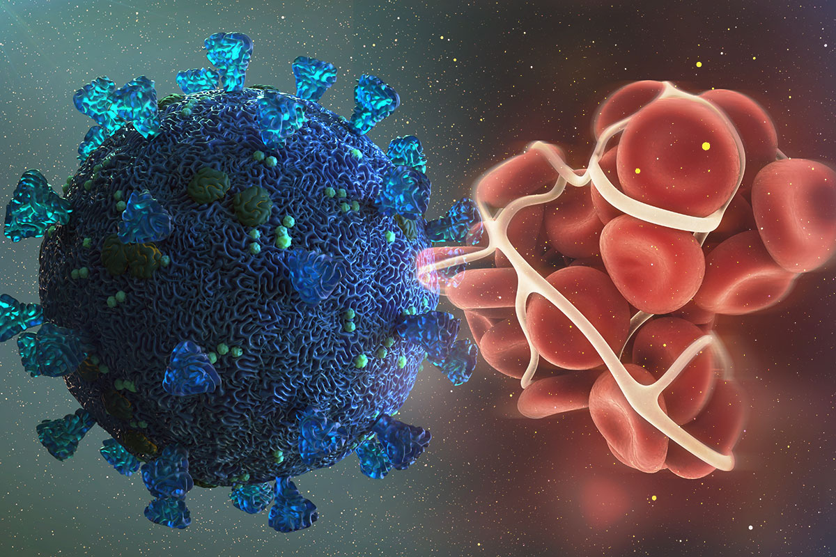 Tromboza e lidhur me pacientët me koronavirus me simptoma të buta