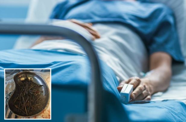 E pazakontë: Mjekët në Lituani gjejnë mbi një kg gozhda dhe vida në stomakun e pacientit