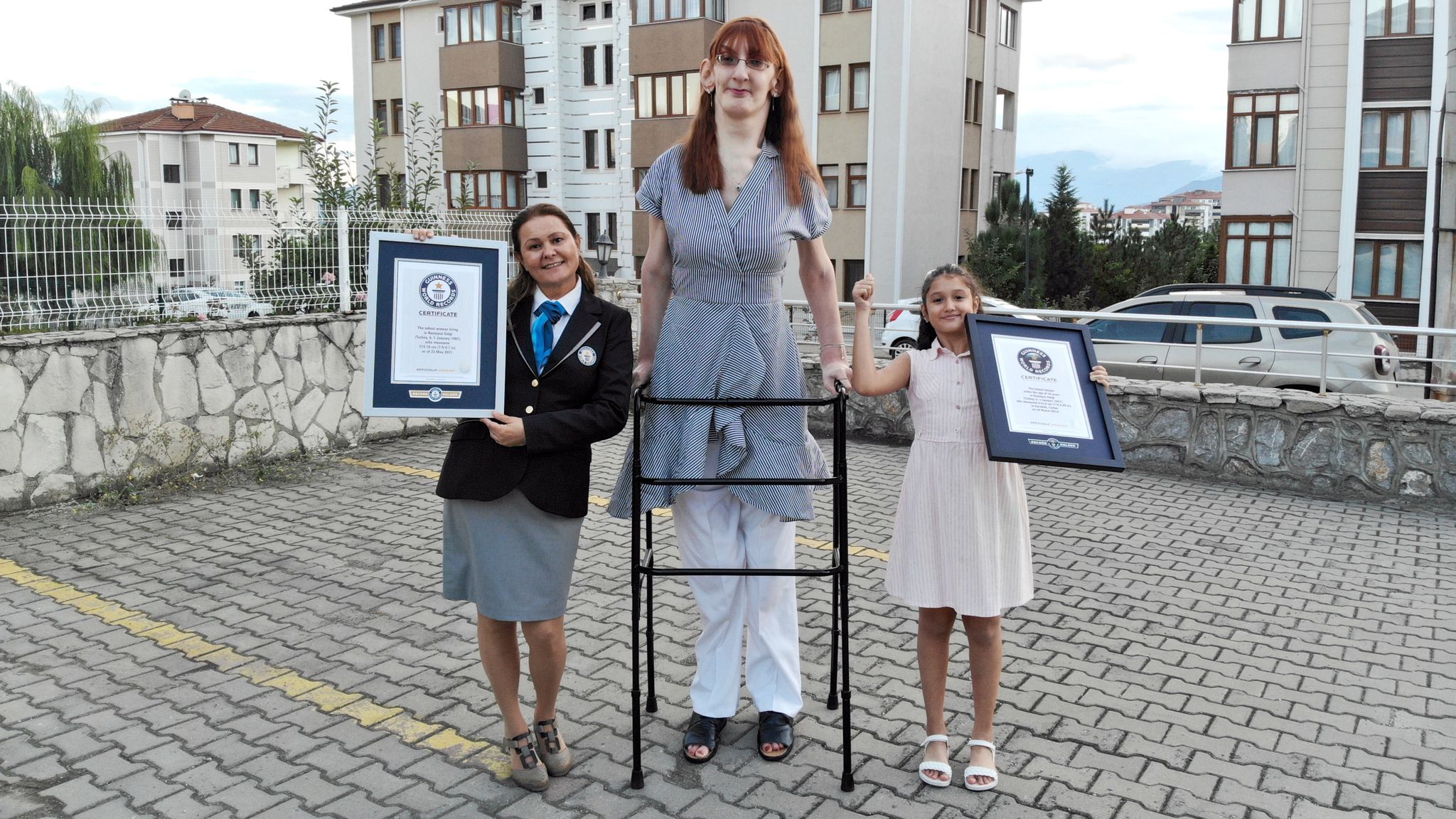 24-vjeçarja turke shpallet gruaja më e gjatë në botë