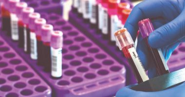 OBSH: Nënshkruhet marrëveshja për teste serologjike falas në vendet e varfra