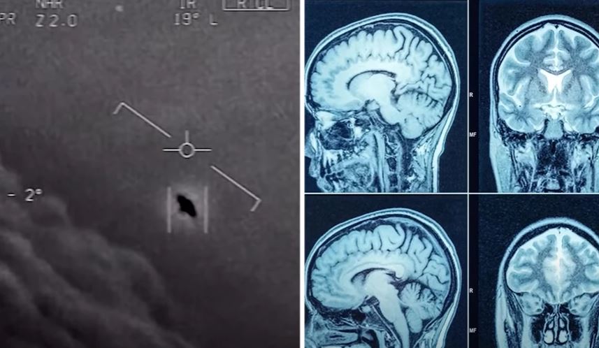 Simptomat e pazakonta të personave që mendohet se kanë takuar UFO-t