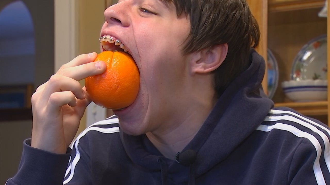 VIDEO/ 14-vjeçari fiton për herë të dytë rekordin Guinness për gojën më të madhe